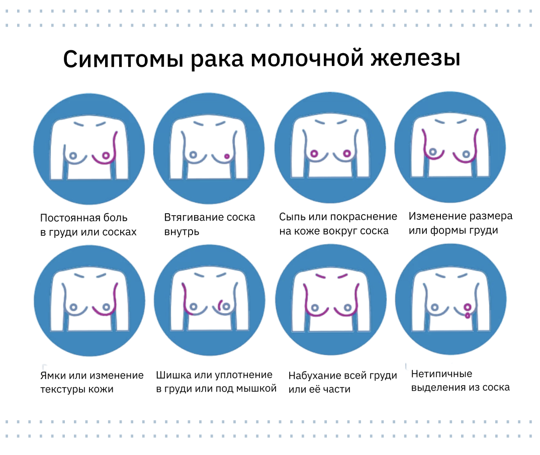 Какие есть факторы риска рака молочной железы и что можно делать для  профилактики - Sektascience: научно-популярный журнал